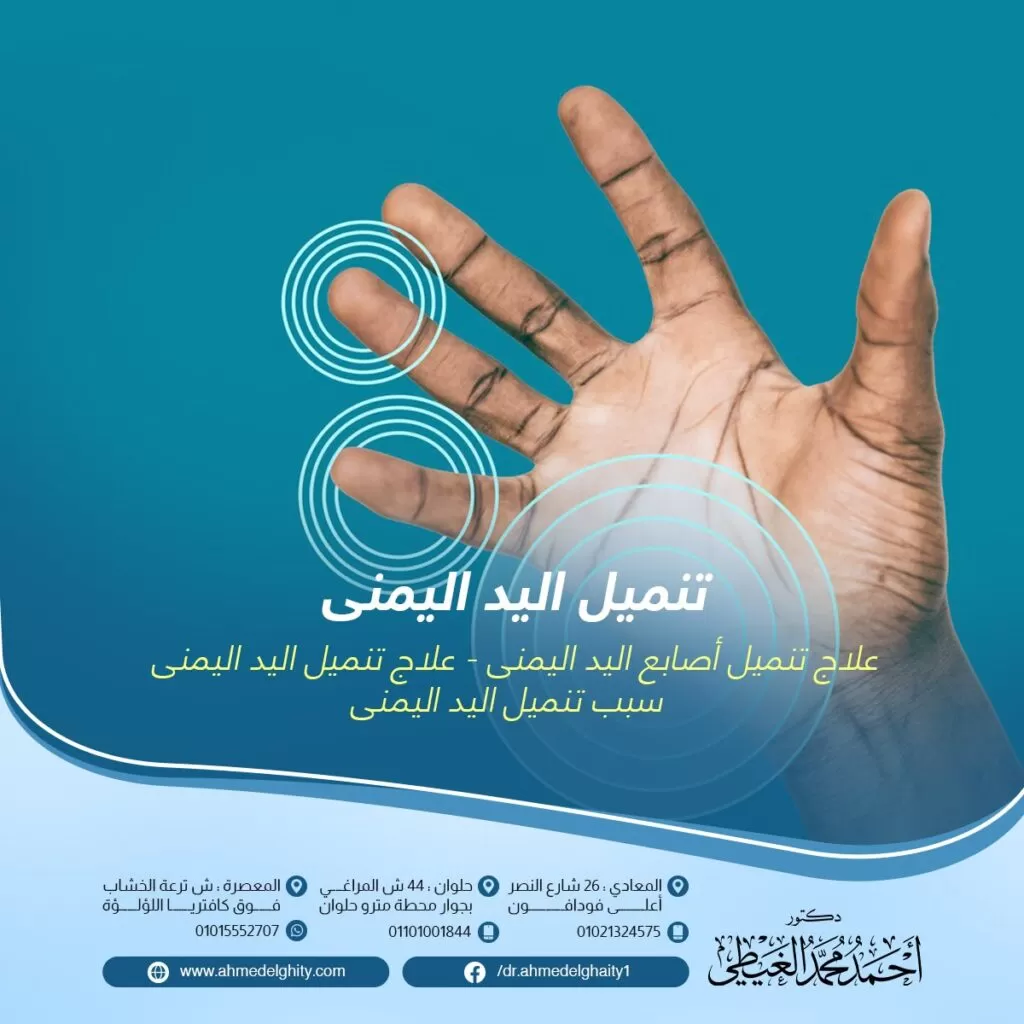 تنميل اليد اليمنى الأسباب، العلاج، وطرق الوقاية