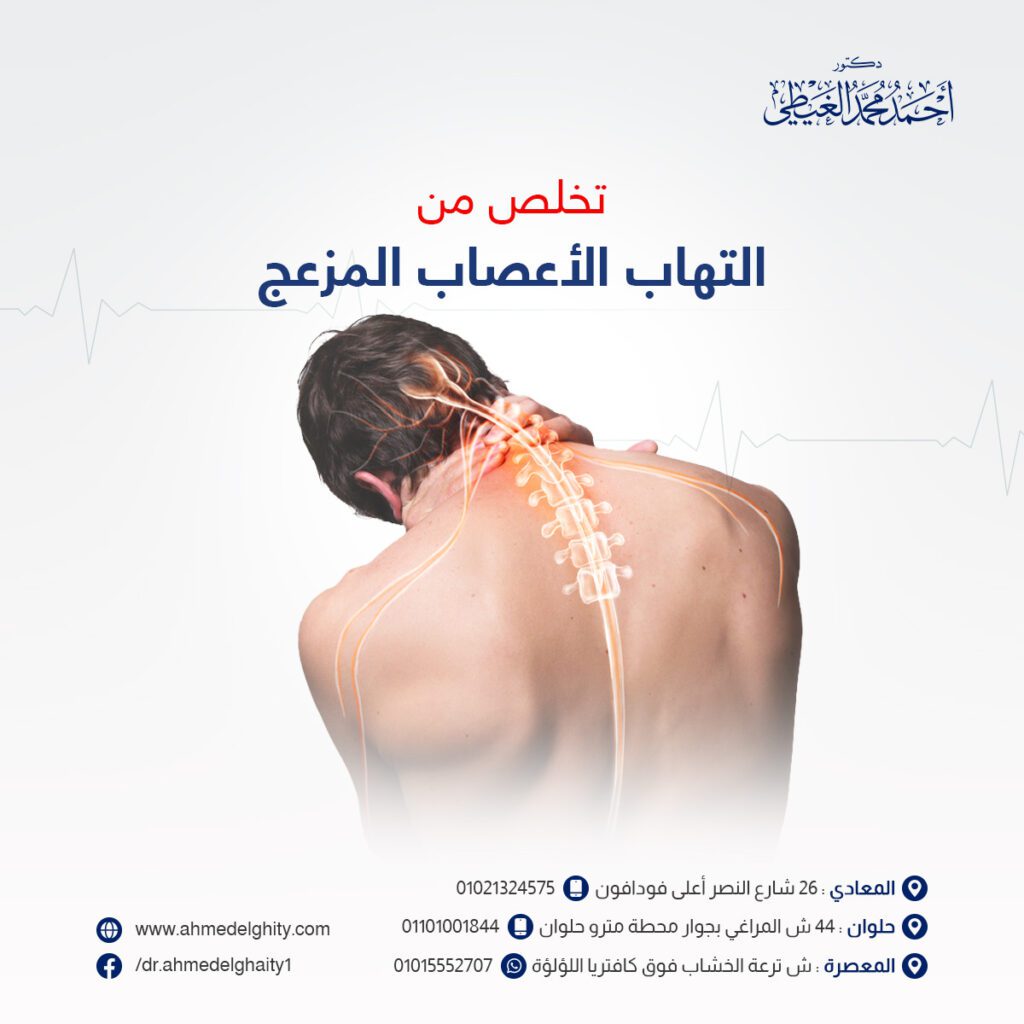 علاج التهاب الأعصاب نهائيا