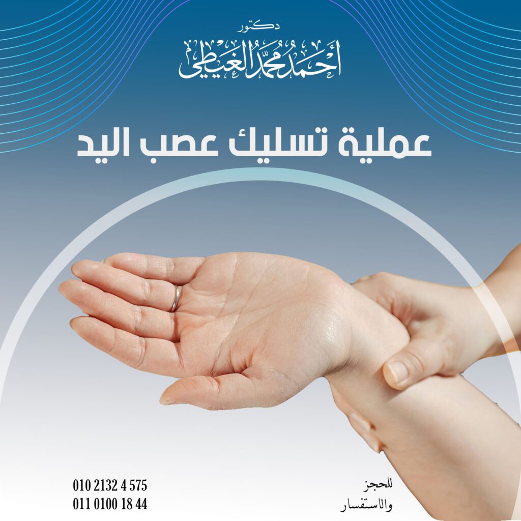 متى يلجأ دكتور أحمد الغيطي إلى عملية تسليك عصب اليد؟