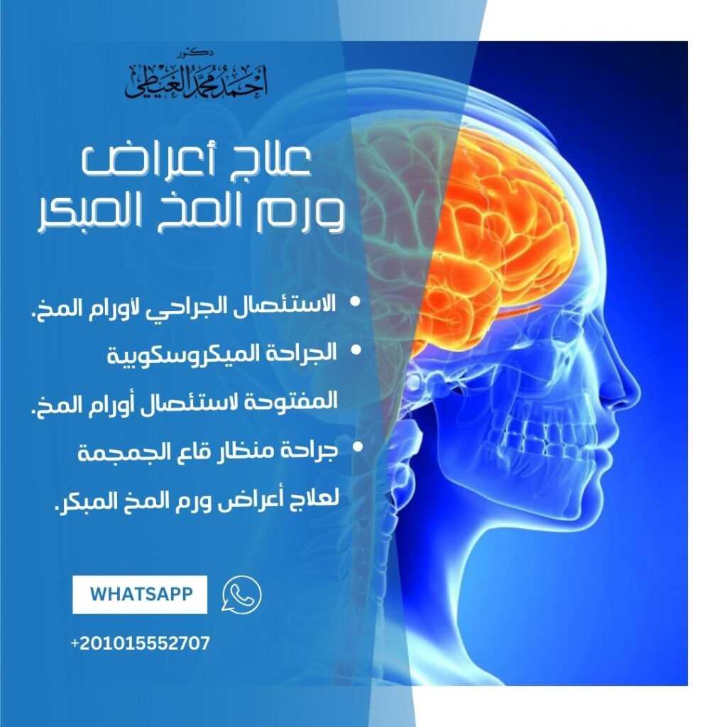 علاج أعراض ورم المخ المبكر