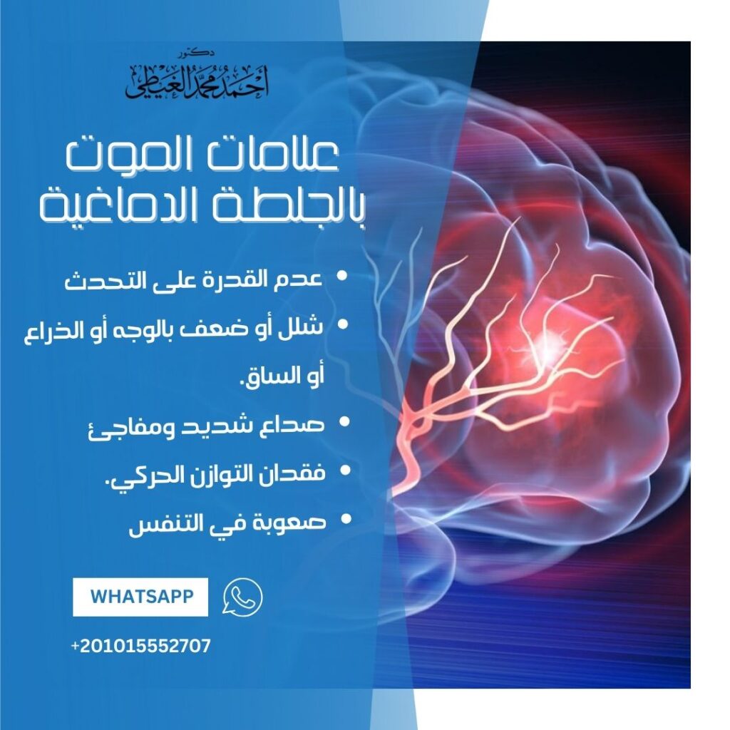 علامات الموت بالجلطة الدماغية 