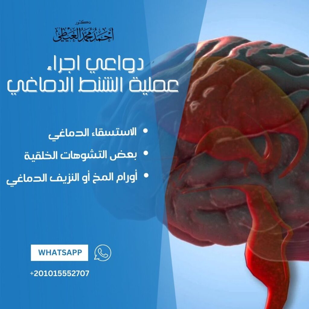 دواعي اجراء عملية الشنط الدماغي