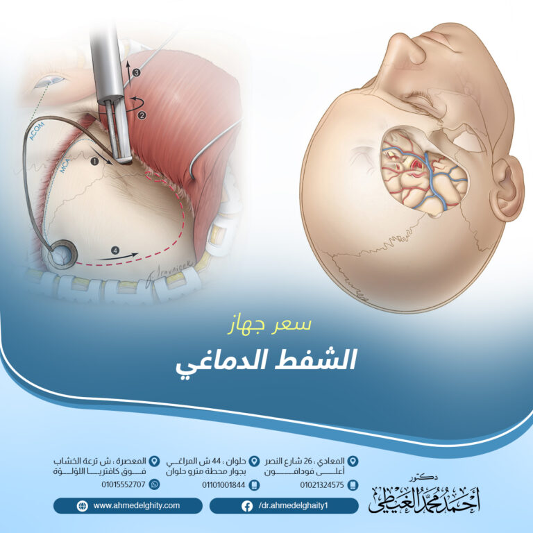 سعر جهاز الشنط الدماغي 2024