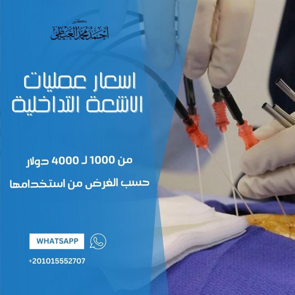 اسعار عمليات الاشعة التداخلية