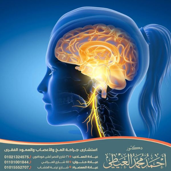 نسبة نجاح عملية صمام المخ