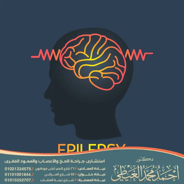 أفضل دكتور لعلاج الصرع في مصر