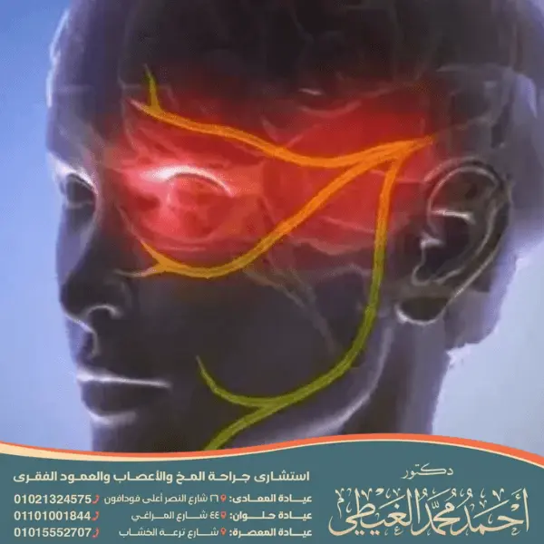 أفضل دكتور لعلاج العصب الخامس