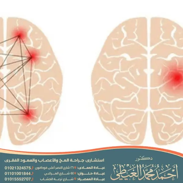 أفضل دكتور لعلاج تشنجات الأطفال