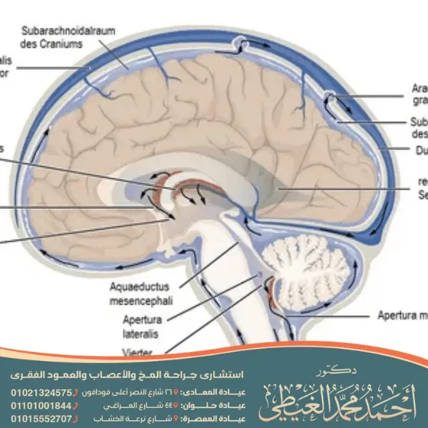 دكتور قسطرة مخية