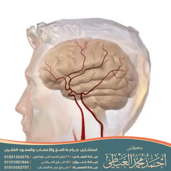 دكتور قسطرة مخية (3)