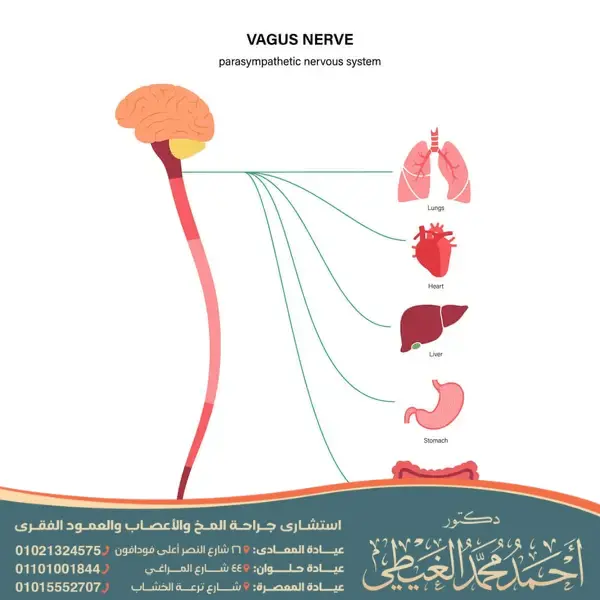 دكتور لعلاج العصب الحائر 