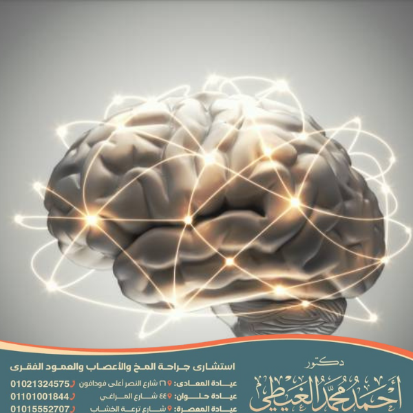 افضل استشاري مخ واعصاب في مصر