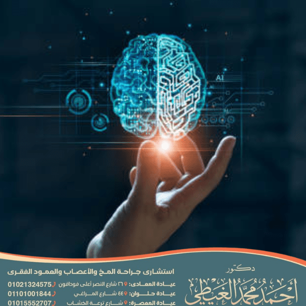 افضل استشاري مخ واعصاب في مصر