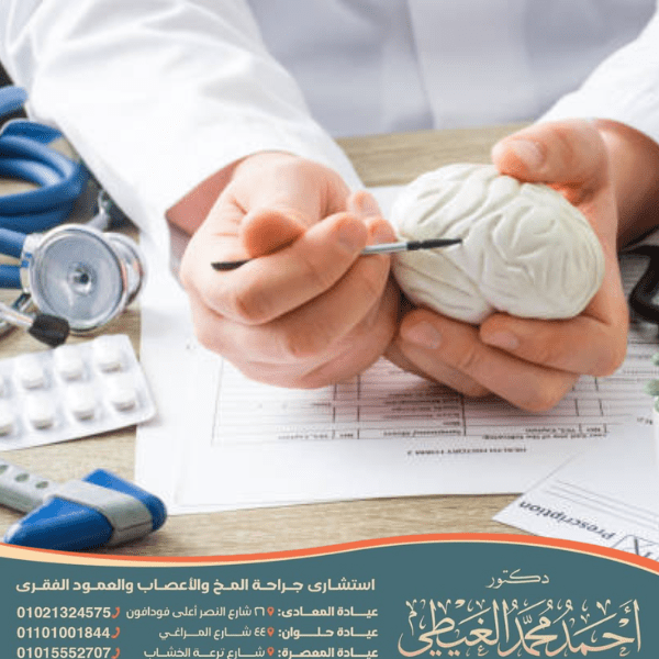 افضل استشاري مخ واعصاب في مصر