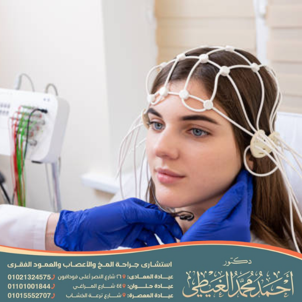 افضل دكتور لعلاج كهرباء المخ