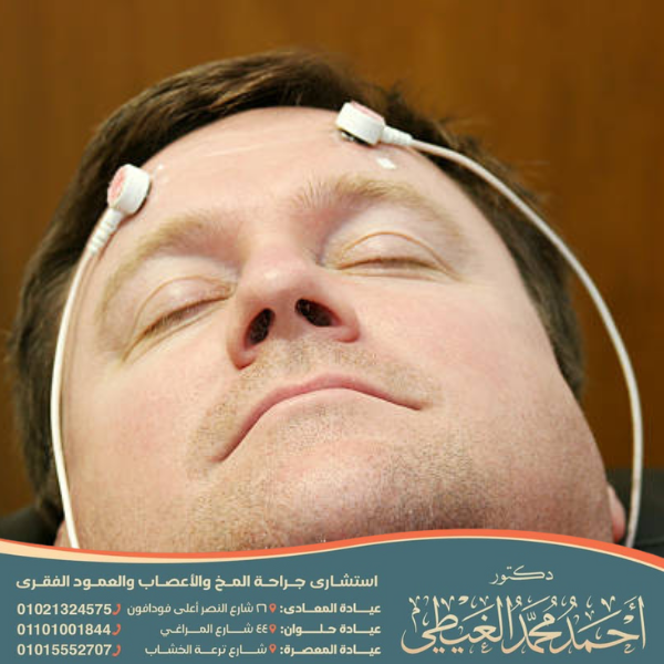 افضل دكتور لعلاج كهرباء المخ