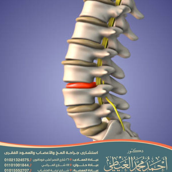 الانزلاق الغضروفي القطني يؤثر على الركبة