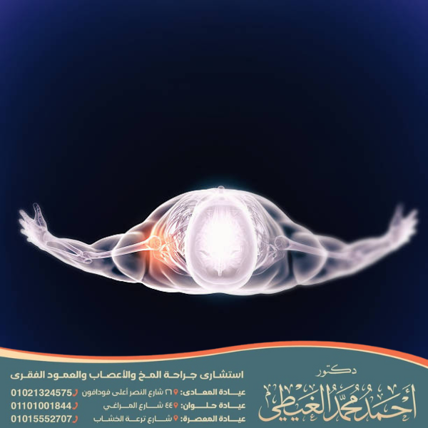 تمارين توسيع القناة العصبية