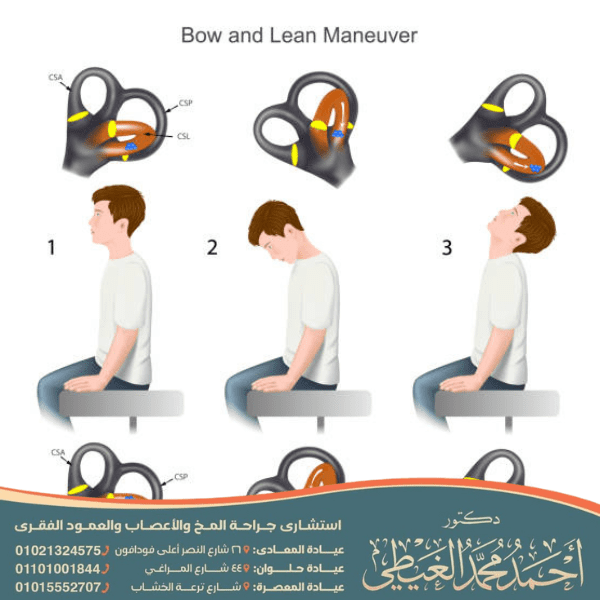 تمارين توسيع القناة العصبية