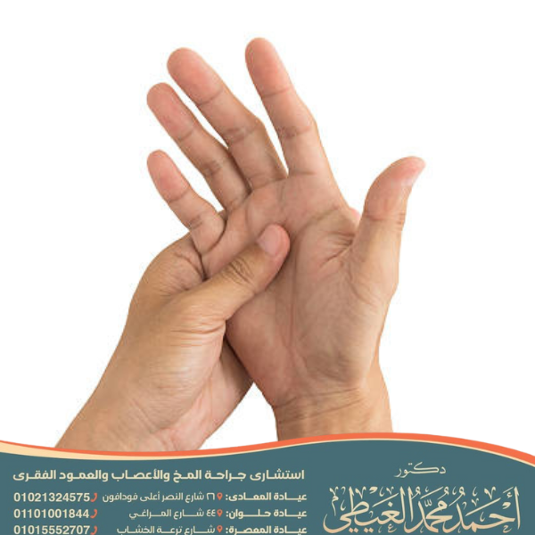 خدر اليد اليمنى متى يكون خطيراً؟