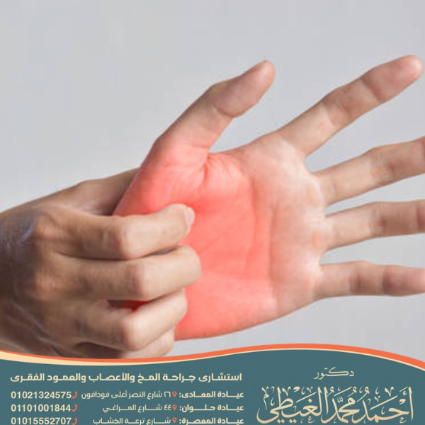 خدر اليد اليمنى متى يكون خطيراً؟ 