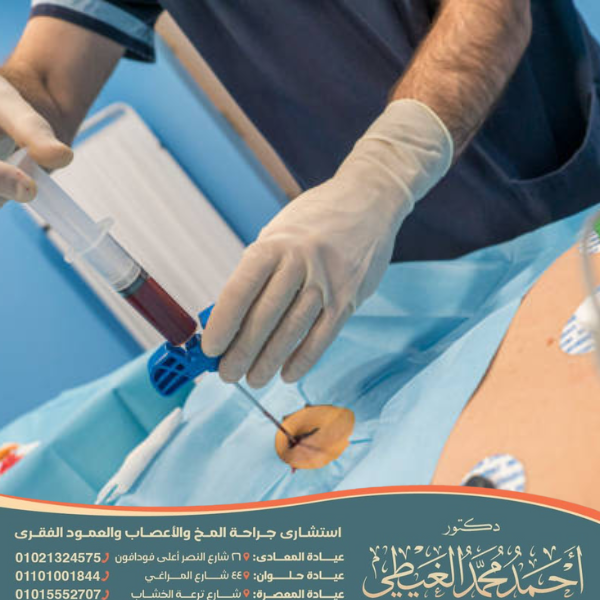 عملية بزل النخاع