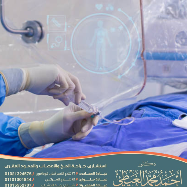 عملية بزل النخاع