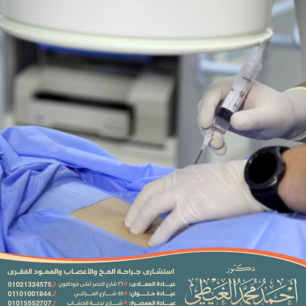 عملية بزل النخاع