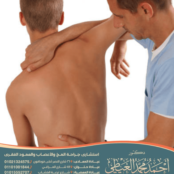 ماهي الرياضة المناسبة لمرضى الانزلاق الغضروفي