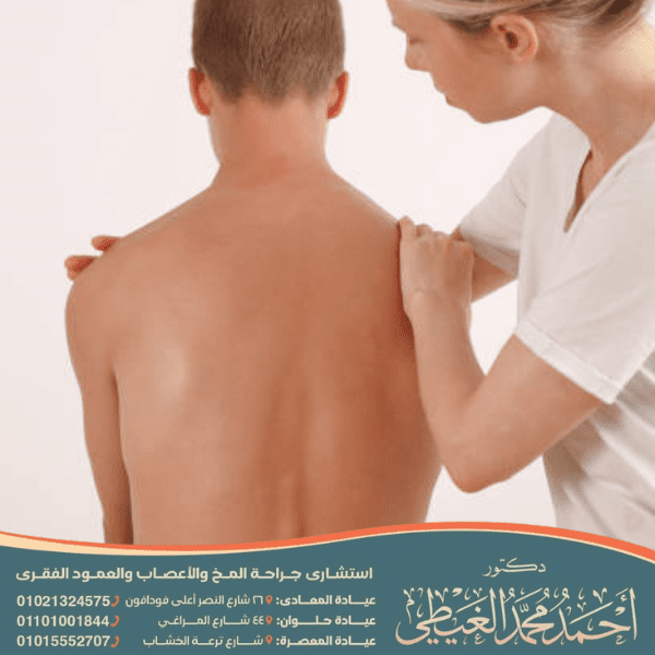 ماهي الرياضة المناسبة لمرضى الانزلاق الغضروفي