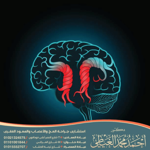 عملية الشنط الدماغي