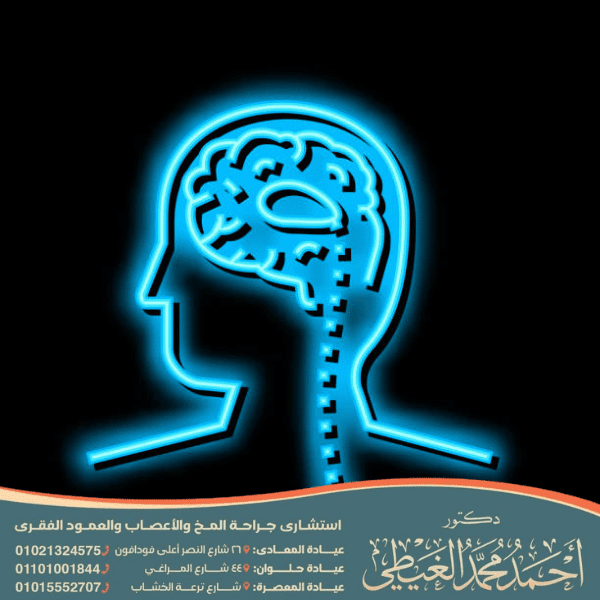 عملية الشنط الدماغي