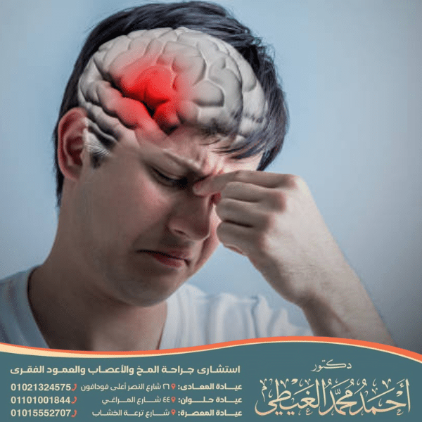 عملية نزيف المخ