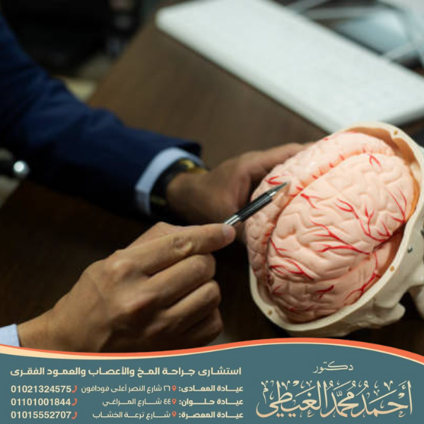 مين احسن دكتور مخ واعصاب في القاهرة