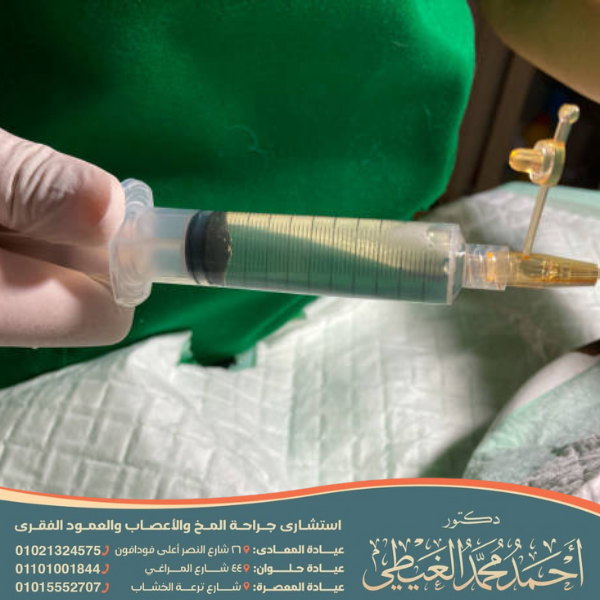 هل تسرب السائل النخاعي خطير
