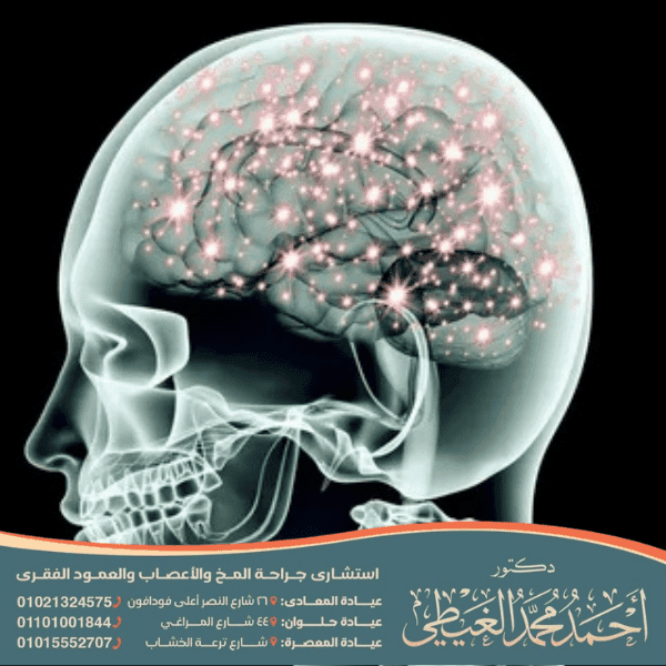 أدوية علاج التهاب الأعصاب في الرأس