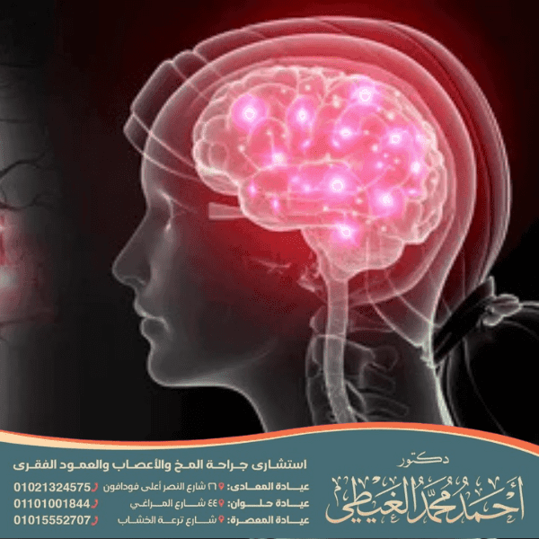 أدوية علاج التهاب الأعصاب في الرأس