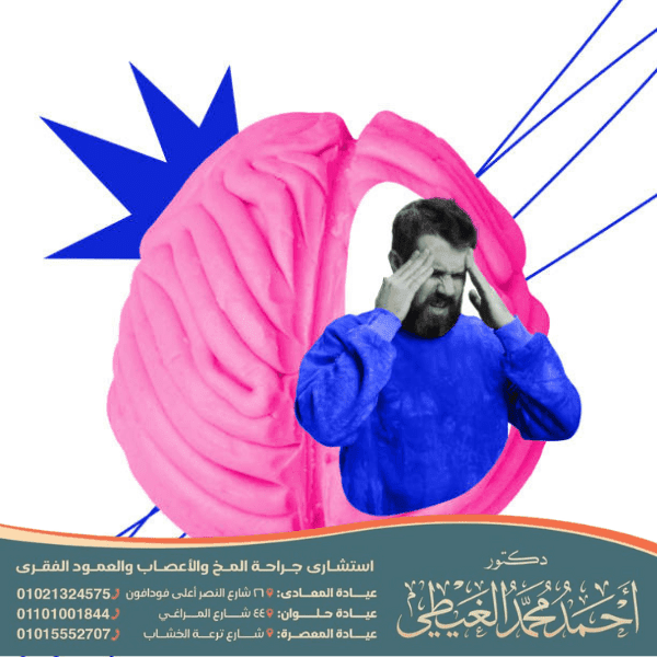 أدوية علاج التهاب الأعصاب في الرأس