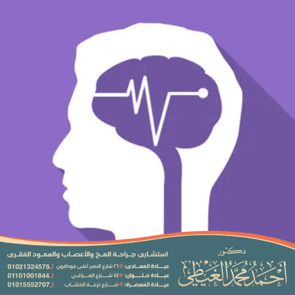 اعراض ما قبل نوبة الصرع