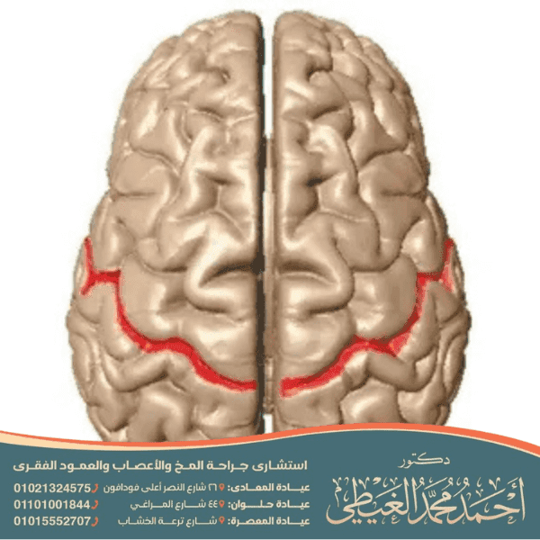 الصرع الرولاندي الخبيث