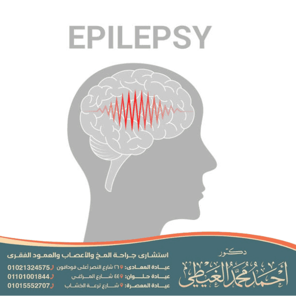 الصرع الرولاندي الخبيث