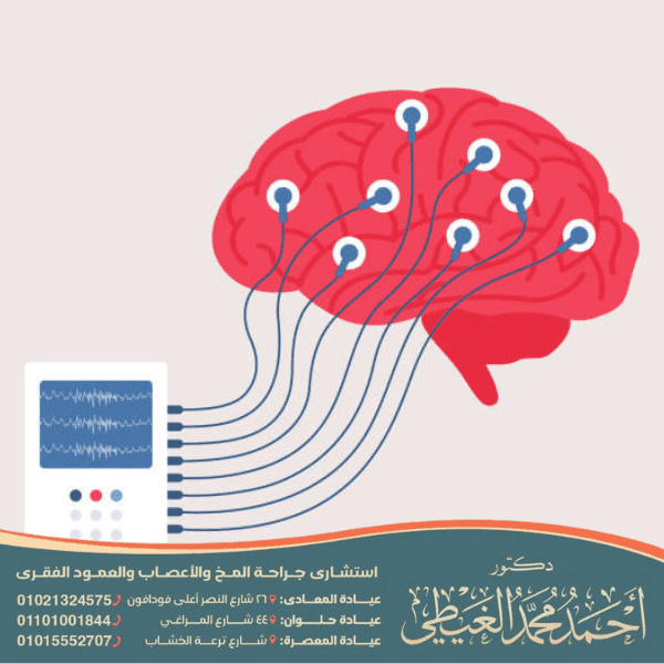 الفرق بين الصرع العضوي والصرع الروحي