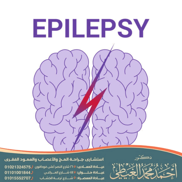 تجربتي في علاج الصرع