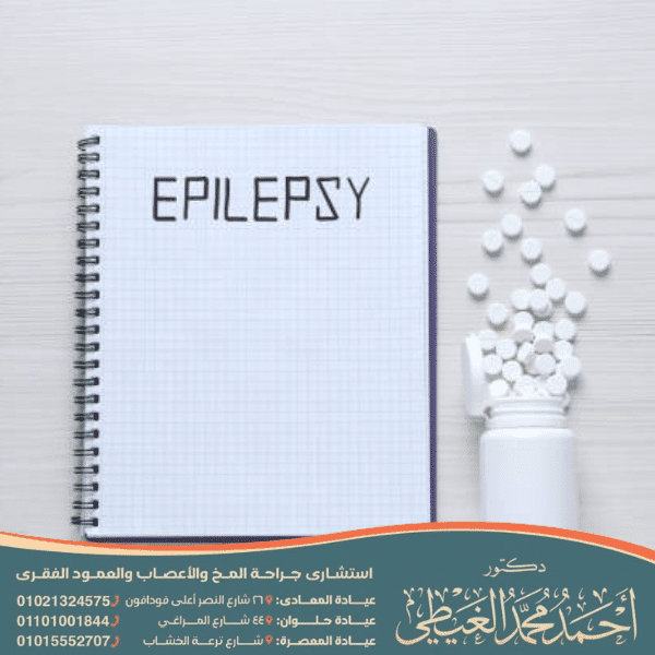 تجربتي في علاج الصرع