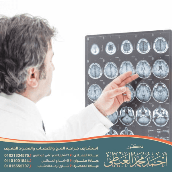 دكتور مخ واعصاب تخصص شلل رعاش