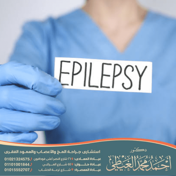علاج الصرع الحميد