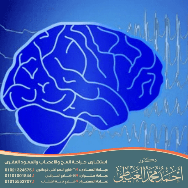 علاج الصرع الحميد