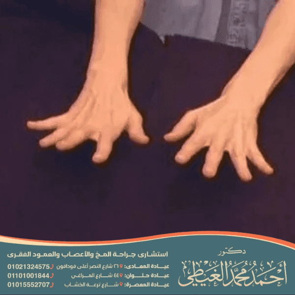 علاج نفضة الجسم المفاجئة عند النوم