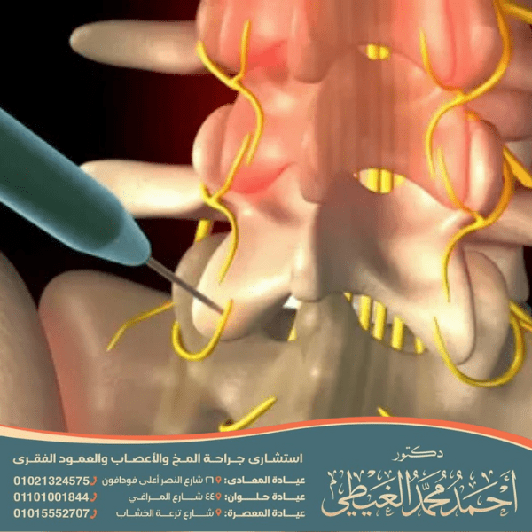 عملية التردد الحراري