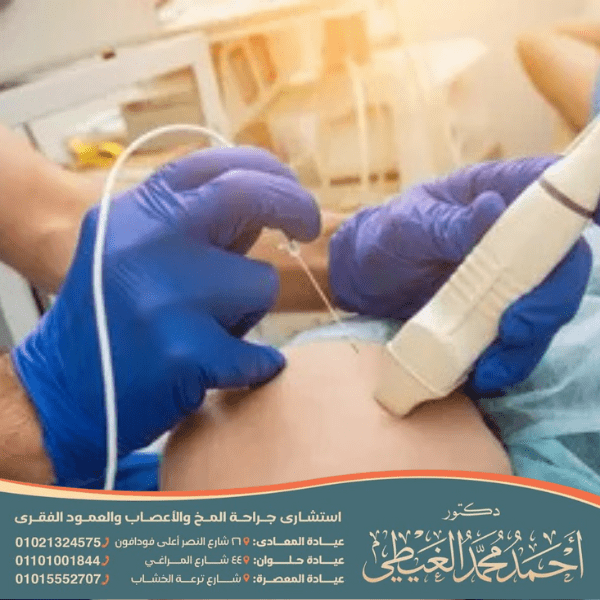 عملية التردد الحراري